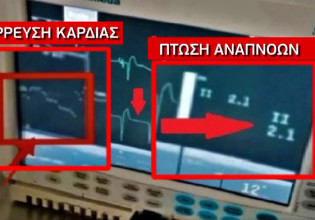 Πάτρα: Οι αποκαλυπτικές ενδείξεις στο μόνιτορ πριν τον θάνατο της Τζωρτζίνας