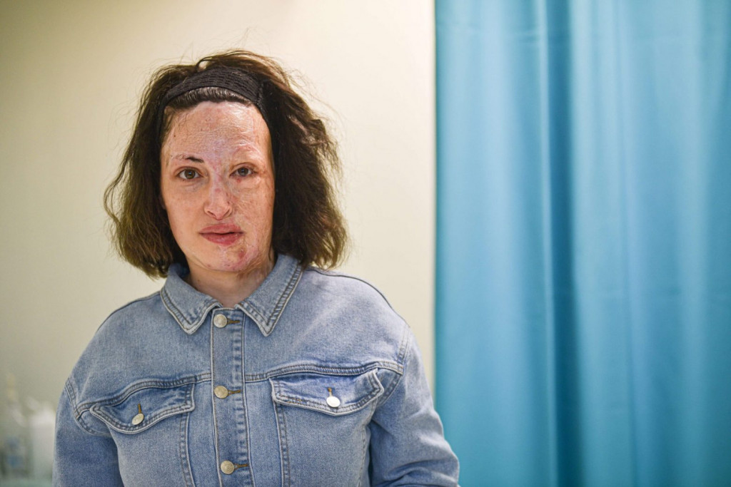 Ιωάννα Παλιοσπύρου: Νέες φωτογραφίες χωρίς τη μάσκα – Πώς είναι η καθημερινότητά της