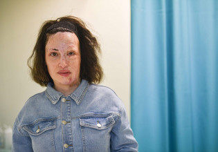 Ιωάννα Παλιοσπύρου: Νέες φωτογραφίες χωρίς τη μάσκα – Πώς είναι η καθημερινότητά της