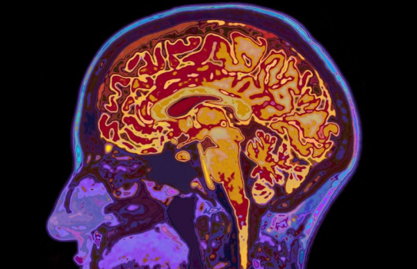 Κοροναϊός: Η άνοια «παραμονεύει» μετά τη βαριά νόσο – Οι συστάσεις των ειδικών