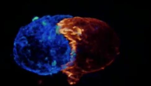 Πώς ένα Τ-λεμφοκύτταρο σκοτώνει τον καρκίνο