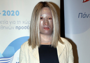 Ιωάννα Παλιοσπύρου: Δείχνει το πρόσωπό της χωρίς τη μάσκα – «Ήρθε η ώρα να ξανασυστηθούμε»