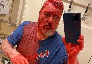 Ρωσία: Επίθεση με κόκκινες μπογιές δέχθηκε ο βραβευμένος με Νόμπελ Ντμίτρι Μουράτοφ