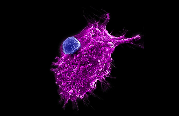 natural killer cell