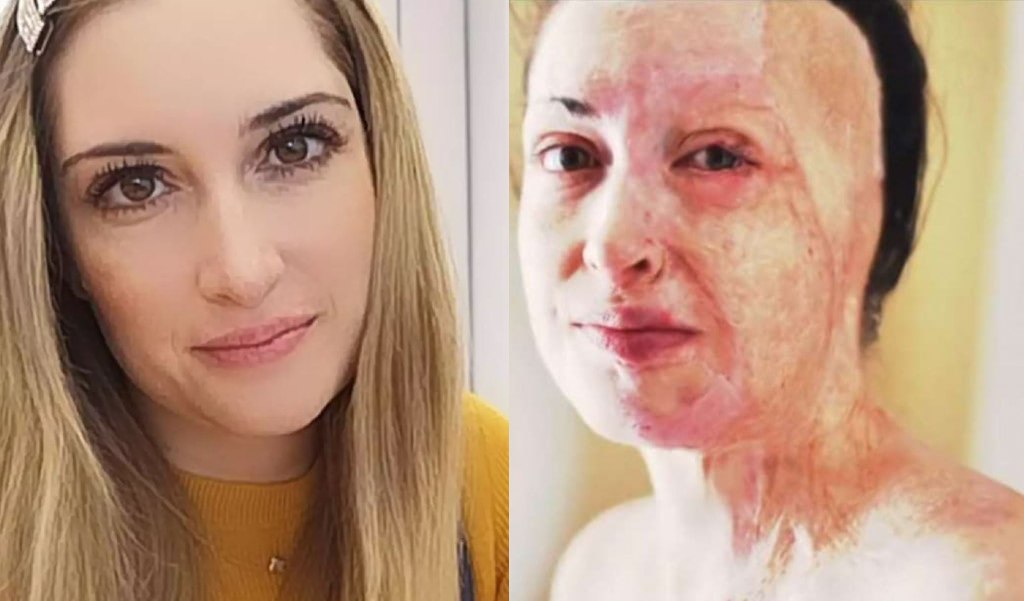 Ιωάννα Παλιοσπύρου: Η αλλαγή στο πρόσωπο της μετά από ένα χρόνο και 10 χειρουργεία