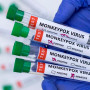Ευλογιά των πιθήκων: Σε αυξητική φάση η επιδημική καμπύλη του ιού, λέει ο Γκίκας Μαγιορκίνης