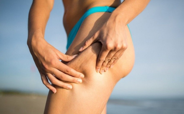 Ποιες τροφές θα πρέπει να βγάλετε από τη διατροφή σας για να αποφύγετε την εμφάνιση κυτταρίτιδας