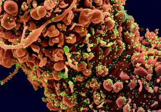 Long Covid: «Φαντάσματα» του κοροναϊού ίσως στοιχειώνουν τους ασθενείς για μήνες