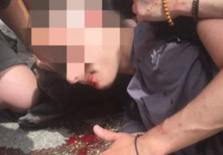 Επεισόδια στο ΑΠΘ: Τραυματίστηκε φοιτητής – Εικόνες & βίντεο