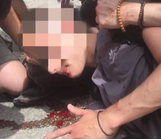 Επεισόδια στο ΑΠΘ: Τραυματίστηκε φοιτητής – Εικόνες & βίντεο