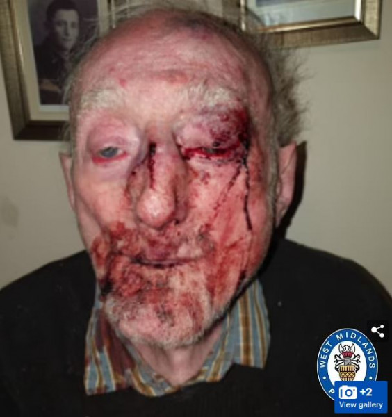 Βρετανία: Άγριος ξυλοδαρμός ηλικιωμένου μέσα στο σπίτι του