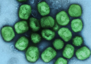 Η ευλογιά των πιθήκων δεν είναι COVID-19, λέει κορυφαίος βρετανός ειδικός