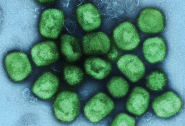 Η ευλογιά των πιθήκων δεν είναι COVID-19, λέει κορυφαίος βρετανός ειδικός