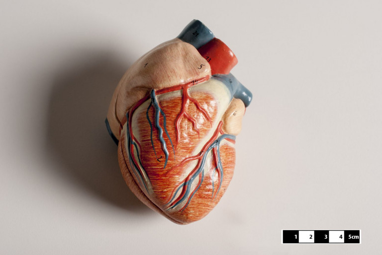 Έμφραγμα: Κύτταρα «αναγέννησαν» την καρδιά μετά από καρδιακό επεισόδιο