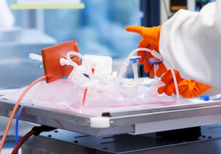 Ευλογιά των πιθήκων: Το πιο μακάβριο και αστείο σχόλιο