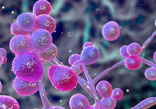 Candida auris: Η νέα απειλή για την δημόσια υγεία – Πώς μπορεί να μεταδοθεί και πώς αντιμετωπίζεται