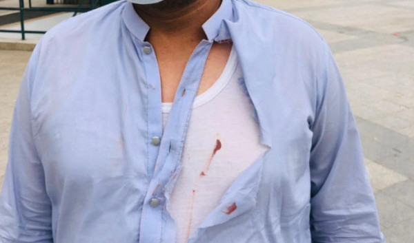 ΚΕΕΡΦΑ: Νέα ρατσιστική επίθεση σε μετανάστες εργάτες στην οδό Πειραιώς – Με σιδερογροθιά και μαχαίρι-πεταλούδα