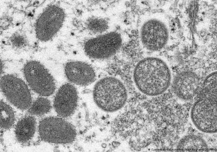 Γερμανία: Προληπτικά μέτρα για την ευλογιά των πιθήκων με καραντίνα 21 ημερών