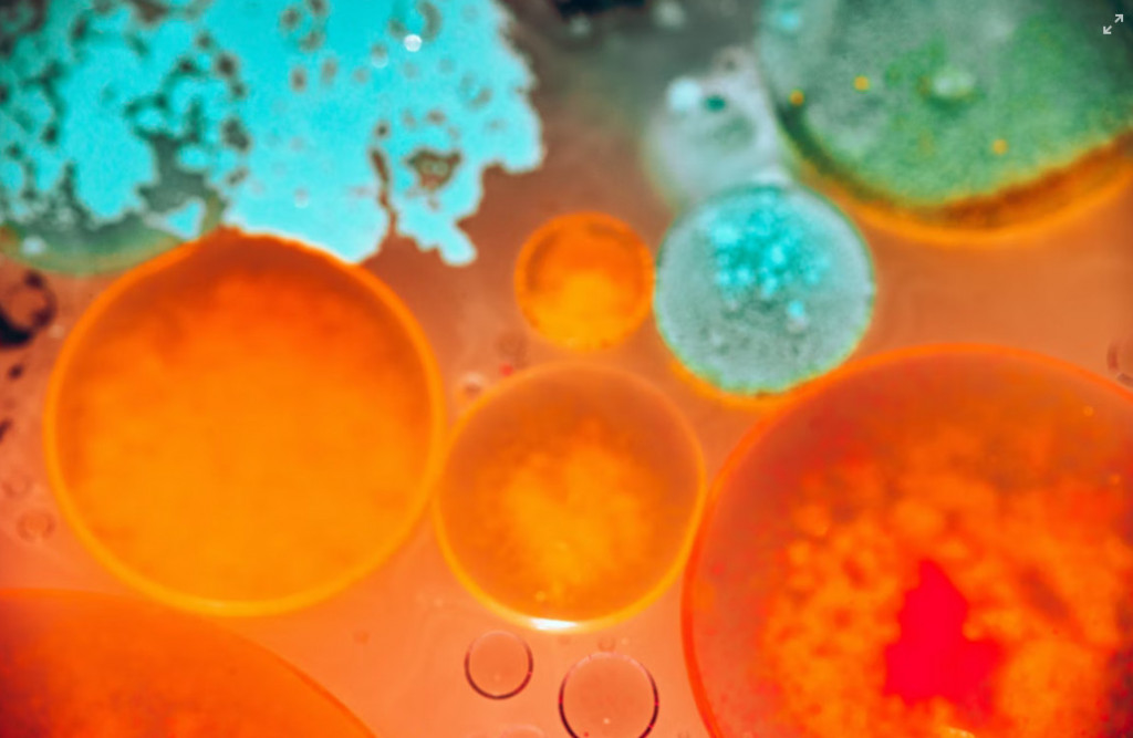 Θάνος Πλεύρης για ευλογιά των πιθήκων: Θα υπάρξει κρούσμα στην Ελλάδα – Θα παραγγείλουμε εμβόλια