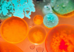 Θάνος Πλεύρης για ευλογιά των πιθήκων: Θα υπάρξει κρούσμα στην Ελλάδα – Θα παραγγείλουμε εμβόλια