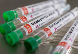 Βρετανία: Καραντίνα 3 εβδομάδων για τις στενές επαφές κρουσμάτων ευλογιάς των πιθήκων