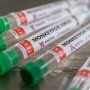 Ευλογιά των πιθήκων: Τι είπε ο Μαγιορκίνης για τον τρόπο μετάδοσης και τον εμβολιασμό