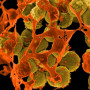 Νέα γενιά αντιβιοτικών υπόσχεται η «συρραφή» γονιδίων από μικρόβια