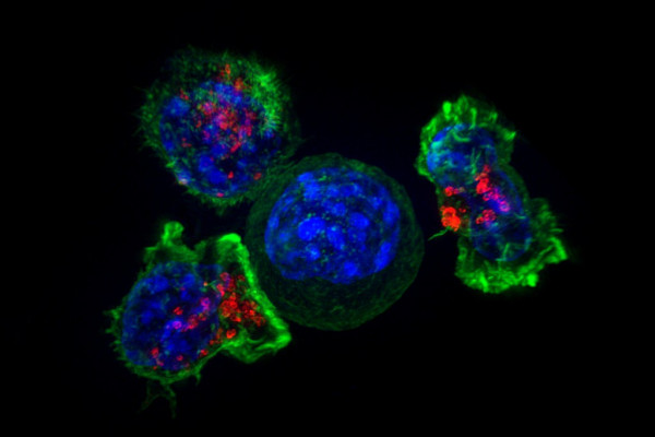 nk cells surrounding tumor