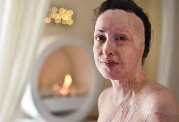 Ολυμπία Κρασαγάκη: «Όταν είδα την Ιωάννα χωρίς μάσκα έπαθα στιγμιαία ένα σοκ»