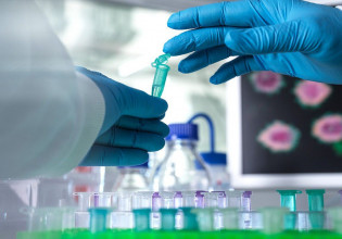 Ευλογιά των πιθήκων: «Καμπανάκι» του ΠΟΥ – «Ο ιός μπορεί να εξαπλωθεί στην Ευρώπη το καλοκαίρι»