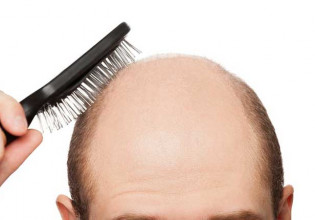 Σεξουαλική παρενόχληση να αποκαλείς τον άνδρα «φαλακρό» με τη βούλα δικαστηρίου