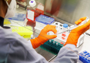 Ευλογιά των πιθήκων: Ακόμα δύο ύποπτα κρούσματα