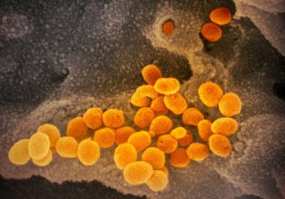 Κοροναϊός: Νέα εξέταση αίματος μετρά τα επίπεδα ανοσίας