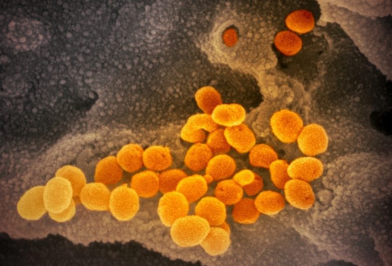 Κοροναϊός: Νέα εξέταση αίματος μετρά τα επίπεδα ανοσίας