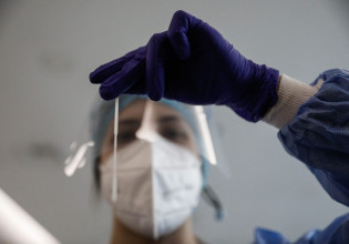 Ευλογιά των πιθήκων: Κούρσα για την ανάπτυξη rapid και PCR test