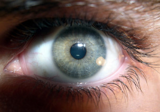 Μαύρη τρύπα: Νέο είδος οφθαλμαπάτης ξεγελά τα αντανακλαστικά