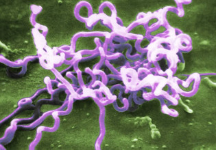 Σύφιλη: Η «ξεχασμένη» ασθένεια που ήταν πάντα εδώ