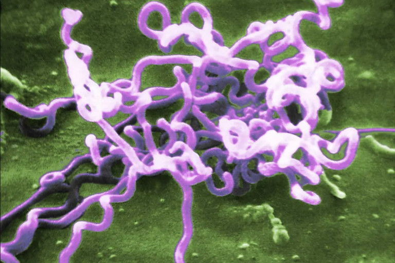 Σύφιλη: Η «ξεχασμένη» ασθένεια που ήταν πάντα εδώ