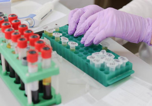 Ευλογιά των πιθήκων:  Θα επιβεβαιωθεί το πρώτο κρούσμα στην Ελλάδα; – Η κατάσταση υγείας του ασθενούς