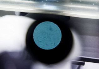 Ευλογιά των πιθήκων: Ποια συμπτώματα μπορεί να έχει κάποιος που νοσεί;