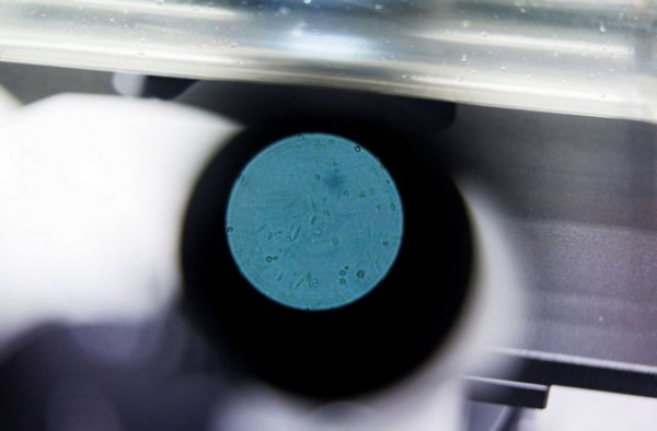 Ευλογιά των πιθήκων: Ποια συμπτώματα μπορεί να έχει κάποιος που νοσεί;