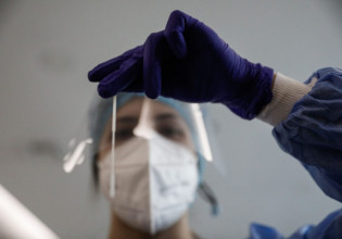 Πλεύρης για ευλογιά των πιθήκων: Κανένας λόγος ανησυχίας