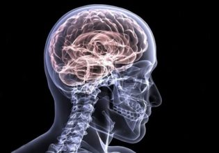 Αλτσχάιμερ: Ανακαλύφθηκε άλλο ένα γονίδιο που αυξάνει τον κίνδυνο, ειδικά για τις γυναίκες