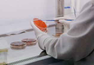 Έρευνα: Ένας στους 500 άνδρες διαθέτει ένα επιπλέον χρωμόσωμα Χ ή Υ που αυξάνει τον κίνδυνο για την υγεία