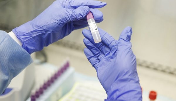 Κορονοϊός: 7.163 νέα κρούσματα, 9 θάνατοι, 99 διασωληνωμένοι