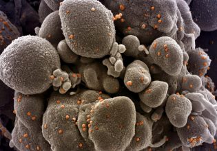 Καρκίνος: Τα τέσσερα πεδία-κλειδιά και οι καινοτόμες θεραπείες