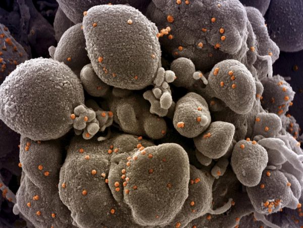 Καρκίνος: Τα τέσσερα πεδία-κλειδιά και οι καινοτόμες θεραπείες