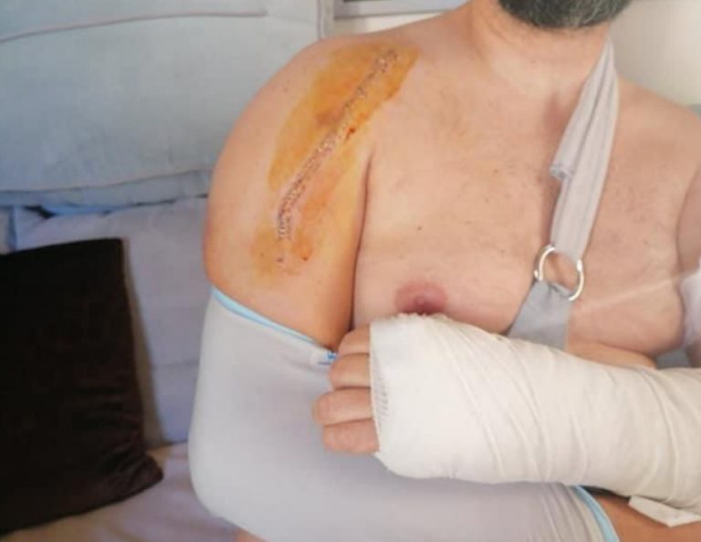 Σαλαμίνα: «Πολύ λεπτή η γραμμή ανάμεσα στη ζωή και τον θάνατο» ο διασώστης του ΕΚΑΒ μετά τον άγριο ξυλοδαρμό