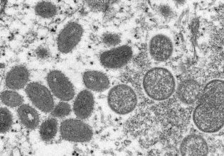 Ευλογιά των πιθήκων: Μεταδίδεται τελικά μέσω του αέρα; – Ο Μαγιορκίνης εξηγεί