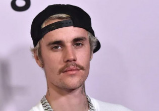 «Δάκρυσα όταν είδα το βίντεο» – Τι λέει Βρετανίδα που πάσχει από το σύνδρομο που «χτύπησε» τον Τζάστιν Μπίμπερ